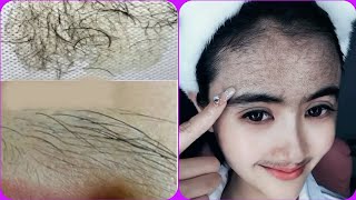 How to get rid of excess hair in 3 minutes You will no longer need to shave [upl. by Irat778]