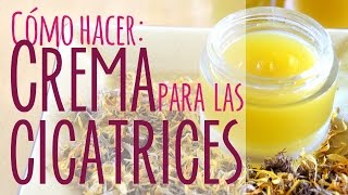 Crema casera para las cicatrices [upl. by Carroll233]