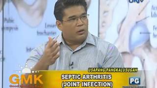 Septic Arthritis Joint Infection [upl. by Jo]