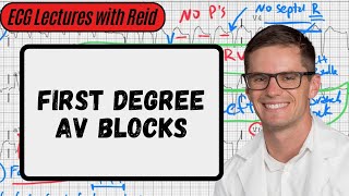 First Degree AV Block  Day 4 ECG Challenge [upl. by Onivag]