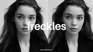 Get Beautiful Freckles on Nose amp Cheeks―∎𝘢𝘶𝘥𝘪𝘰 𝘢𝘧𝘧𝘪𝘳𝘮𝘢𝘵𝘪𝘰𝘯𝘴 [upl. by Miquela]