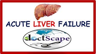 ACUTE LIVER FAILURE by DoctScape [upl. by Windy]