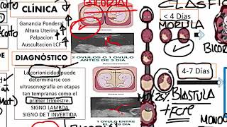 Obstetricia  4 RM19 2V DÍA 2 OBSTETRICIA GESTACION MULTIPLE de Qx Medic on Vimeo [upl. by Philippa]