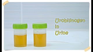 Urobilinogen in Urine [upl. by Ynoyrb]