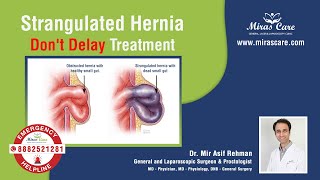 Strangulated Hernia  Dont Delay Treatment  Dr Mir Asif Rehman DNB  General Surgery Mirascare [upl. by Gleason]