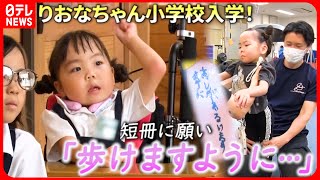 【りおなちゃん】小学校で友達も！quot歩けるように…quot 再生医療への挑戦と続くリハビリ『every特集』 [upl. by Debora]