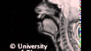 MRI voiced labiodental approximant [upl. by Even411]