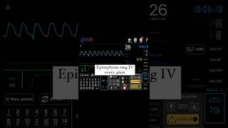 Non Shockable Rhythms PEAPulseless Electrical Activity and Asystole [upl. by Enelym756]