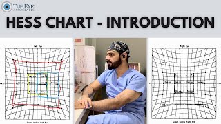 Hess Chart  Introduction [upl. by Nrubyar]