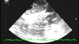 Heartworm disease echocardiography [upl. by Attennod]