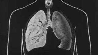 Tuberculosis and How it May be Avoided 1930 Pt 1 of 3 [upl. by Dnalerb]