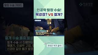 인공막 탈장 수술은 복강경 수술 VS 절개 수술 탈장 탈장수술 탈장병원 탈장통증 복강경 복강경수술 탈장치료 송파구병원 한솔병원 [upl. by Bbor933]