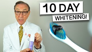 Hismile Purple Toothpaste for 10 Days  Dentist Review teethwhitening [upl. by Renzo940]