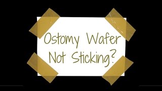 Ostomy wafer not sticking Here are a few tips [upl. by Amimej]