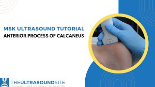 MSK ultrasound evaluation on how to find the anterior process of the calcaneus [upl. by Ennovi]