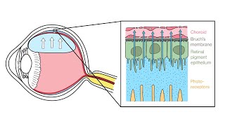 Mechanism of Retinal Reattachment Following Pneumatic Retinopexy [upl. by Rehpotisrhc]