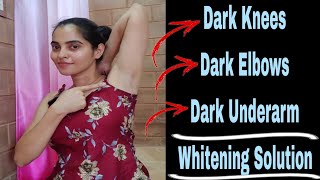 Dark UnderarmDark ElbowsDark Knees Whitening Solution nimmaashwini underarmwhitening [upl. by Jairia]