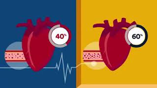 Ejection Fraction  Heart Health  Rose Heart amp Vascular Center [upl. by Hildagarde424]