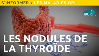 Information Patient  Les nodules de la thyroïde [upl. by Saibot]