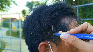 pulling out the white hair removal for Mr 6cong asmr [upl. by Layor]