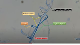 Conidia Phialides and Conidiophores of Trichoderma in LPCB Preparation [upl. by Ernesto931]