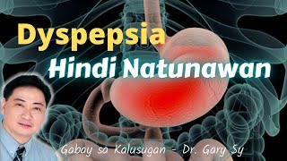 HINDI NATUNAWAN Dyspepsia SelfHelp Techniques  Dr Gary Sy [upl. by Jocko275]