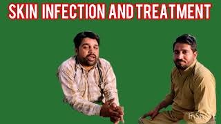 skin infection skin infection medicinedr Allah rakhaskininfection [upl. by Hayden]