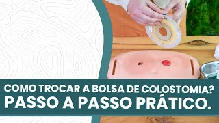 Como colocar uma bolsa de colostomia Como trocar a bolsa de colostomia [upl. by Jemima]