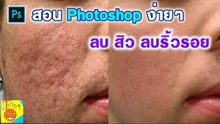 สอนแต่งรูป Photoshop ลบสิว ลบริ้วรอย ง่ายๆ ผู้เริ่มต้นก็ทำได้ [upl. by Colton467]