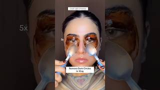 Remove Dark Circles Naturally At Home In 1DayUnderEye Dark Circles Remove Homeremedy dark shorts [upl. by Elocin865]