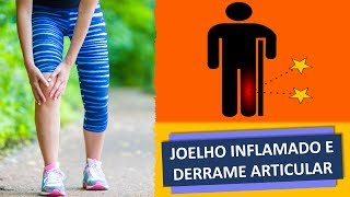 JOELHO INFLAMADO E DERRAME ARTICULAR [upl. by Sinclair376]