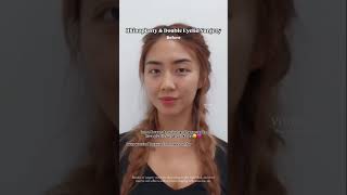 I am a KoreanAmerican and happened tohave plastic surgery in Korea😆🩷 [upl. by Dosi]