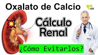 Prevención del Cólico Renal por Oxalato de Calcio Recomendaciones Médicas [upl. by Taggart]