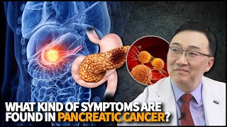 What kind of symptoms are found in Pancreatic Cancer [upl. by Nahaj791]