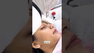 Experience safe and effective nevus removal with Dr Ajay Rana [upl. by Refotsirk439]