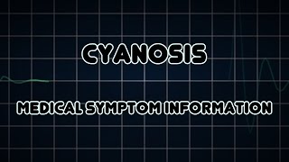 Cyanosis Medical Symptom [upl. by Savory439]