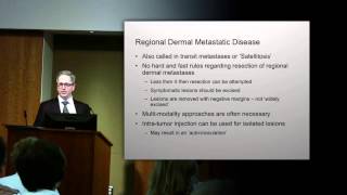 Treatment of Locally and Regionally Advanced Melanoma [upl. by Jessi370]