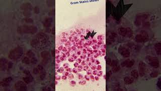 Gram Stain Smear  Neisseria gonorrhoeae  Microbiology science biology microbiology medical [upl. by Witcher74]