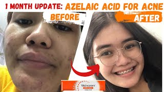 SKINOREN CREAM REVIEW  AZELAIC ACID [upl. by Alhan]