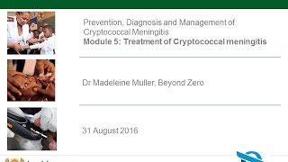 BZ video tutorial CM Module 5 Treatment of CM [upl. by Yrrak52]