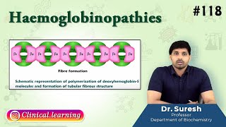 118 Haemoglobinopathies  Medical Biochemistry  USMLE FMGE and NEET PG [upl. by Mccutcheon]