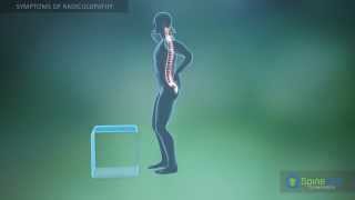 Radiculopathy Symptoms [upl. by Nawaj706]