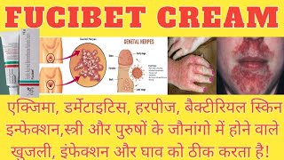 FUCIBET CREAM  हर तरह के स्किन इनफेक्शन और घाव को ठीक करने वाला दावा बैक्टीरियल इनफेक्शन का दावा [upl. by Ennaitak]