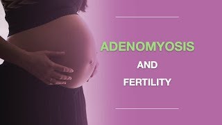 Adenomyosis and Fertility What You Should Know About Adenomyosis And Pregnancy [upl. by Lemuel740]