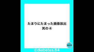 Diabetes糖尿病食事療法運動療法減量CKD網膜症白内障下肢閉塞性動脈硬化足病変 [upl. by Tychon381]