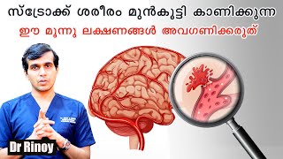 സ്ട്രോക്ക് ശരീരം മുൻകൂട്ടി കാണിക്കുന്ന ഈ മൂന്നു ലക്ഷണങ്ങൾ അവഗണിക്കരുത് Dr Rinoy Stroke [upl. by Egor416]