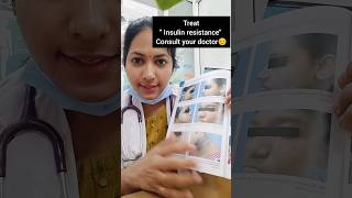 Read the description drdivya doctor drdivyat acanthosisnigricans darkneck healthtipinkannada [upl. by Kiernan478]