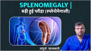 तिल्ली का बढ़ना Enlarged Spleen  किस वजह से होती है तिल्ली की बीमारी  जानिए लक्षण और उपचार [upl. by Licec]