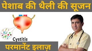 Cystitis  Bladder Pain Pesab Ki Theli Ki Sujan  Pesab Khulkar Nahi Aana  Homeopathy For Cystitis [upl. by Azilef912]