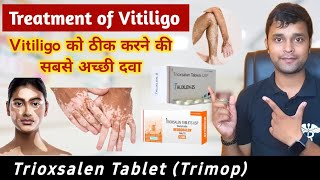 Trioxsalen tablets usp 25 mg  Vitiligo  Leucoderma Treatment In Hindi  सफ़ेद दाग़ कारण इलाज [upl. by Nnyw449]